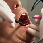Can I Sue My Dentist for malpractice?