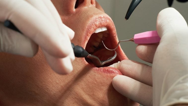 Can I Sue My Dentist for malpractice?