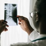 Car Accidents and Long-Term Spinal Cord Injury Consequences