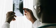 Car Accidents and Long-Term Spinal Cord Injury Consequences