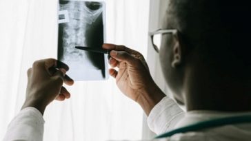 Car Accidents and Long-Term Spinal Cord Injury Consequences