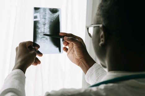 Car Accidents and Long-Term Spinal Cord Injury Consequences